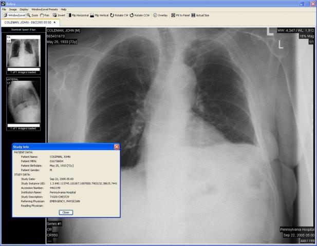 Chest X-Ray and Study Info Dialog