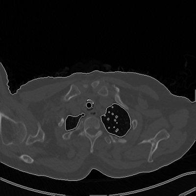 Using EasyBMP for medical image segmentation